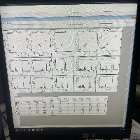 BD FACSymphony A3 - 5Laser image 0